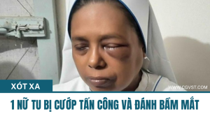 Xót xa - 1 Nữ tu bị cướp tấn công và đánh bầm mặt